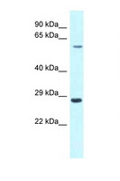 CPNE3 Antibody - CPNE3 antibody Western blot of Fetal Heart lysate. Antibody concentration 1 ug/ml.  This image was taken for the unconjugated form of this product. Other forms have not been tested.