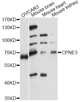 CPNE3 Antibody - Western blot analysis of extracts of various cell lines, using CPNE3 antibody at 1:1000 dilution. The secondary antibody used was an HRP Goat Anti-Rabbit IgG (H+L) at 1:10000 dilution. Lysates were loaded 25ug per lane and 3% nonfat dry milk in TBST was used for blocking. An ECL Kit was used for detection and the exposure time was 60s.