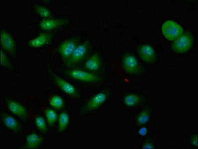 CPNE4 Antibody - Immunofluorescent analysis of A549 cells using CPNE4 Antibody at dilution of 1:100 and Alexa Fluor 488-congugated AffiniPure Goat Anti-Rabbit IgG(H+L)