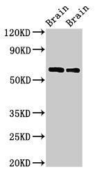 CPNE4 Antibody - Western Blot Positive WB detected in: Rat brain tissue, Mouse brain tissue All lanes: CPNE4 antibody at 2µg/ml Secondary Goat polyclonal to rabbit IgG at 1/50000 dilution Predicted band size: 63, 65 kDa Observed band size: 63 kDa
