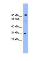 CPNE6 / N-COPINE Antibody - CPNE6 antibody Western blot of Fetal Brain lysate.  This image was taken for the unconjugated form of this product. Other forms have not been tested.