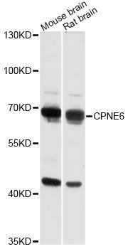 CPNE6 / N-COPINE Antibody - Western blot analysis of extracts of various cell lines, using CPNE6 antibody at 1:3000 dilution. The secondary antibody used was an HRP Goat Anti-Rabbit IgG (H+L) at 1:10000 dilution. Lysates were loaded 25ug per lane and 3% nonfat dry milk in TBST was used for blocking. An ECL Kit was used for detection and the exposure time was 10s.