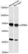 CPNE6 / N-COPINE Antibody - Western blot analysis of extracts of various cell lines, using CPNE6 antibody at 1:3000 dilution. The secondary antibody used was an HRP Goat Anti-Rabbit IgG (H+L) at 1:10000 dilution. Lysates were loaded 25ug per lane and 3% nonfat dry milk in TBST was used for blocking. An ECL Kit was used for detection and the exposure time was 10s.