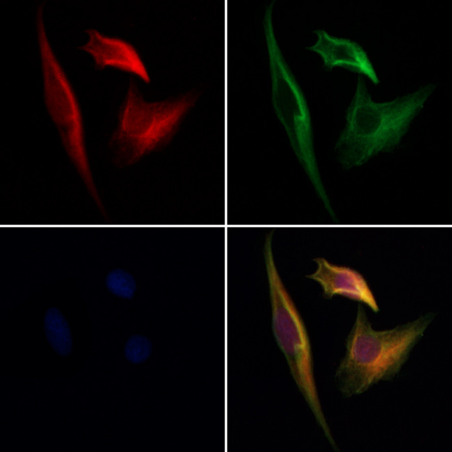 CPNE6 / N-COPINE Antibody - Staining HeLa cells by IF/ICC. The samples were fixed with PFA and permeabilized in 0.1% Triton X-100, then blocked in 10% serum for 45 min at 25°C. Samples were then incubated with primary Ab(1:200) and mouse anti-beta tubulin Ab(1:200) for 1 hour at 37°C. An AlexaFluor594 conjugated goat anti-rabbit IgG(H+L) Ab(1:200 Red) and an AlexaFluor488 conjugated goat anti-mouse IgG(H+L) Ab(1:600 Green) were used as the secondary antibod
