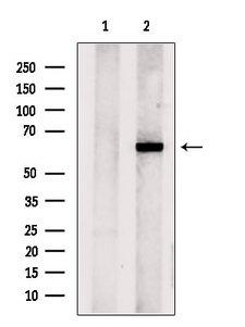 CPNE6 / N-COPINE Antibody