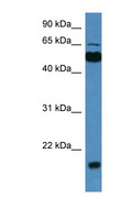 CPNE7 Antibody - CPNE7 antibody Western blot of Rat Brain lysate. This image was taken for the unconjugated form of this product. Other forms have not been tested.