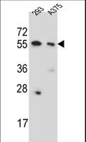 CPNE8 / Copine VIII Antibody - CPNE8 Antibody western blot of 293,A375 cell line lysates (35 ug/lane). The CPNE8 antibody detected the CPNE8 protein (arrow).