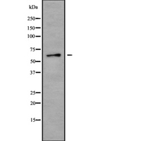 CPNE8 / Copine VIII Antibody - Western blot analysis of Copine 8 using K562 whole cells lysates