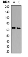 CPNE8 / Copine VIII Antibody - Western blot analysis of Copine 8 expression in A431 (A); NIH3T3 (B) whole cell lysates.