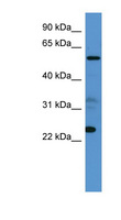 CPNE9 Antibody - CPNE9 antibody Western blot of 721_B cell lysate. This image was taken for the unconjugated form of this product. Other forms have not been tested.