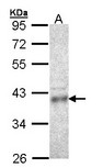 CPOX Antibody - Sample (30 ug of whole cell lysate). A: HCT116 10% SDS PAGE. CPOX antibody diluted at 1:1000.