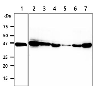 CPOX Antibody - The cell lysates (40ug) were resolved by SDS-PAGE, transferred to PVDF membrane and probed with anti-human CPOX antibody (1:500). Proteins were visualized using a goat anti-mouse secondary antibody conjugated to HRP and an ECL detection system. Lane 1.: Recombinant protein CPOX Lane 2.: 293T cell lysate Lane 3.: HepG2 cell lysate Lane 4.: A549 cell lysate Lane 5.: Jurkat cell lysate Lane 6.: K562 cell lysate Lane 7.: LnCaP cell lysate