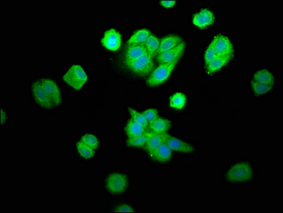 CPOX Antibody - Immunofluorescence staining of HepG2 cells at a dilution of 1:100, counter-stained with DAPI. The cells were fixed in 4% formaldehyde, permeabilized using 0.2% Triton X-100 and blocked in 10% normal Goat Serum. The cells were then incubated with the antibody overnight at 4 °C.The secondary antibody was Alexa Fluor 488-congugated AffiniPure Goat Anti-Rabbit IgG (H+L) .