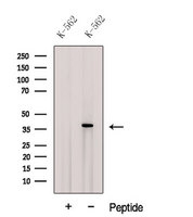 CPOX Antibody - Western blot analysis of extracts of K562 cells using CPOX antibody. The lane on the left was treated with blocking peptide.