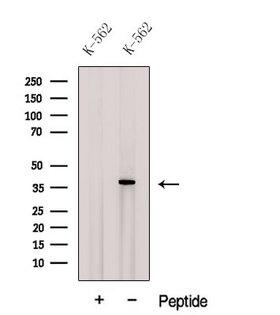 CPOX Antibody - Western blot analysis of extracts of K562 cells using CPOX antibody. The lane on the left was treated with blocking peptide.