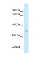 CPPED1 Antibody - CPPED1 antibody Western blot of HeLa Cell lysate. Antibody concentration 1 ug/ml.  This image was taken for the unconjugated form of this product. Other forms have not been tested.