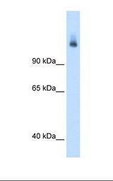 CPS1 Antibody - Fetal liver cell lysate. Antibody concentration: 1.25 ug/ml. Gel concentration: 8%.  This image was taken for the unconjugated form of this product. Other forms have not been tested.