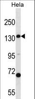CPS1 Antibody - CPS1 Antibody western blot of HeLa cell line lysates (35 ug/lane). The CPS1 antibody detected the CPS1 protein (arrow).