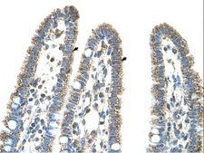 CPS1 Antibody - CPS1 antibody CPS1(carbamoyl-phosphate synthetase 1, mitochondrial) Antibody was used in IHC to stain formalin-fixed, paraffin-embedded human intestine.  This image was taken for the unconjugated form of this product. Other forms have not been tested.