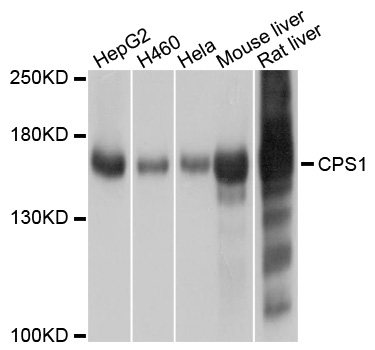 CPS1 Antibody - Western blot analysis of extracts of various cell lines.