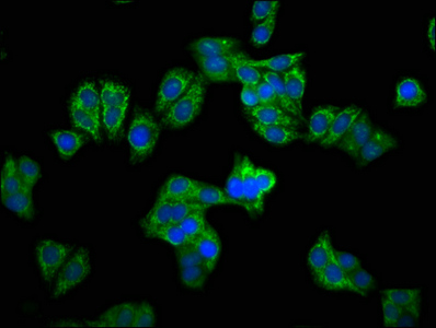 CPS1 Antibody - Immunofluorescence staining of HepG2 cells at a dilution of 1:100, counter-stained with DAPI. The cells were fixed in 4% formaldehyde, permeabilized using 0.2% Triton X-100 and blocked in 10% normal Goat Serum. The cells were then incubated with the antibody overnight at 4°C.The secondary antibody was Alexa Fluor 488-congugated AffiniPure Goat Anti-Rabbit IgG (H+L) .