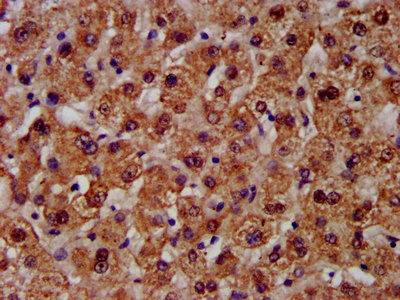 CPS1 Antibody - Immunohistochemistry image at a dilution of 1:300 and staining in paraffin-embedded human liver tissue performed on a Leica BondTM system. After dewaxing and hydration, antigen retrieval was mediated by high pressure in a citrate buffer (pH 6.0) . Section was blocked with 10% normal goat serum 30min at RT. Then primary antibody (1% BSA) was incubated at 4 °C overnight. The primary is detected by a biotinylated secondary antibody and visualized using an HRP conjugated SP system.