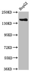 CPS1 Antibody - Positive Western Blot detected in HepG2 whole cell lysate. All lanes: CPS1 antibody at 3.8 µg/ml Secondary Goat polyclonal to rabbit IgG at 1/50000 dilution. Predicted band size: 165, 117, 166 KDa. Observed band size: 165 KDa