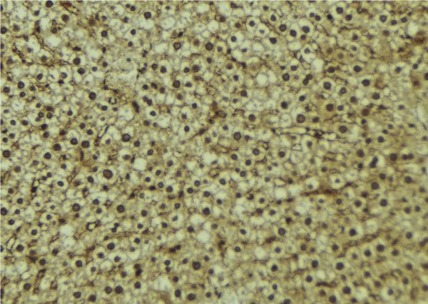 CPS1 Antibody - 1:100 staining mouse liver tissue by IHC-P. The sample was formaldehyde fixed and a heat mediated antigen retrieval step in citrate buffer was performed. The sample was then blocked and incubated with the antibody for 1.5 hours at 22°C. An HRP conjugated goat anti-rabbit antibody was used as the secondary.