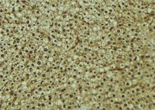 CPS1 Antibody - 1:100 staining mouse liver tissue by IHC-P. The sample was formaldehyde fixed and a heat mediated antigen retrieval step in citrate buffer was performed. The sample was then blocked and incubated with the antibody for 1.5 hours at 22°C. An HRP conjugated goat anti-rabbit antibody was used as the secondary.