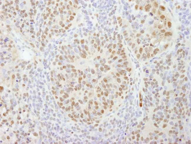 CPSF160 / CPSF1 Antibody - Detection of Mouse CPSF160 by Immunohistochemistry. Sample: FFPE section of mouse teratoma. Antibody: Affinity purified rabbit anti-CPSF160 used at a dilution of 1:100.