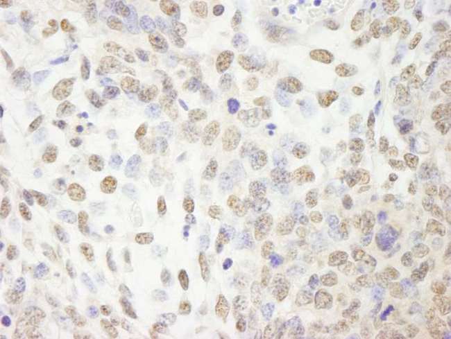 CPSF2 Antibody - Detection of Mouse CPSF100 Immunohistochemistry. Sample: FFPE section of mouse teratoma. Antibody: Affinity purified rabbit anti-CPSF100 used at a dilution of 1:250.