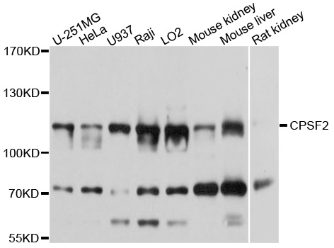 CPSF2 Antibody - Western blot analysis of extracts of various cells.