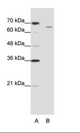 CPSF3 / CPSF Antibody - B: Jurkat Cell Lysate.  This image was taken for the unconjugated form of this product. Other forms have not been tested.