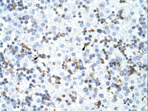 CPSF3 / CPSF Antibody - CPSF3 antibody ARP40841_T100-NP_057291-CPSF3 (cleavage and polyadenylation specific factor 3, 73kDa) Antibody was used in IHC to stain formalin-fixed, paraffin-embedded human liver.  This image was taken for the unconjugated form of this product. Other forms have not been tested.