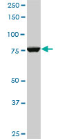 CPSF3 / CPSF Antibody - CPSF3 monoclonal antibody (M06), clone 1H8. Western blot of CPSF3 expression in PC-12.