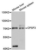 CPSF3 / CPSF Antibody - Western blot analysis of extracts of various cell lines, using CPSF3 antibody at 1:3000 dilution. The secondary antibody used was an HRP Goat Anti-Rabbit IgG (H+L) at 1:10000 dilution. Lysates were loaded 25ug per lane and 3% nonfat dry milk in TBST was used for blocking. An ECL Kit was used for detection and the exposure time was 10s.