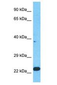 CPSF3L Antibody - CPSF3L antibody Western Blot of HeLa. Antibody dilution: 1 ug/ml.  This image was taken for the unconjugated form of this product. Other forms have not been tested.