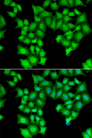 CPSF3L Antibody - Immunofluorescence analysis of HeLa cells.