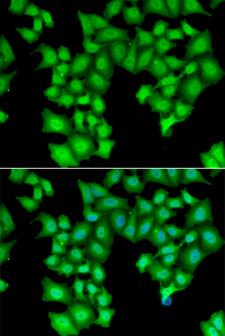 CPSF3L Antibody - Immunofluorescence analysis of HeLa cells.