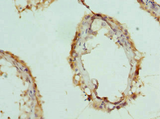 CPSF3L Antibody - Immunohistochemistry of paraffin-embedded human testis tissue at dilution 1:100