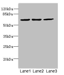 CPSF3L Antibody - Western blot All Lanes: CPSF3Lantibody at 2ug/ml Lane 1 : Colo320 whole cell lysate Lane 2 : Hela whole cell lysate Lane 3 : MCF7 whole cell lysate Secondary Goat polyclonal to Rabbit IgG at 1/10000 dilution Predicted band size: 68,57,66,65,69 kDa Observed band size: 68 kDa