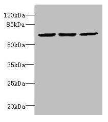 CPSF3L Antibody - Western blot All lanes: CPSF3L antibody at 2µg/ml Lane 1: Colo320 whole cell lysate Lane 2: Hela whole cell lysate Lane 3: MCF-7 whole cell lysate Secondary Goat polyclonal to rabbit IgG at 1/10000 dilution Predicted band size: 68, 57, 66, 65, 69 kDa Observed band size: 68 kDa