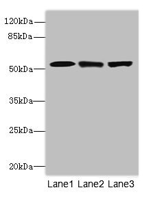 CPSF3L Antibody - Western blot All Lanes: CPSF3Lantibody at 4.2ug/ml Lane 1 : Colo320 whole cell lysate Lane 2 : Hela whole cell lysate Lane 3 : MCF7 whole cell lysate Secondary Goat polyclonal to Rabbit IgG at 1/10000 dilution Predicted band size: 68,57,66,65,69 kDa Observed band size: 68 kDa