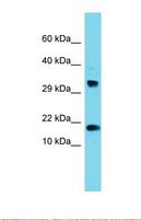 CPSF4L Antibody - Western blot of Human 293T. CPSF4L antibody dilution 1.0 ug/ml.  This image was taken for the unconjugated form of this product. Other forms have not been tested.