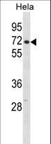 CPSF6 Antibody - CPSF6 Antibody western blot of HeLa cell line lysates (35 ug/lane). The CPSF6 antibody detected the CPSF6 protein (arrow).