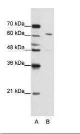 CPSF6 Antibody - B: Jurkat Cell Lysate.  This image was taken for the unconjugated form of this product. Other forms have not been tested.