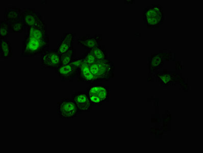 CPSF6 Antibody - Immunofluorescent analysis of MCF-7 cells at a dilution of 1:100 and Alexa Fluor 488-congugated AffiniPure Goat Anti-Rabbit IgG(H+L)