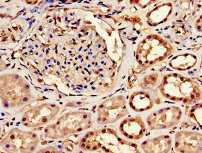 CPSF6 Antibody - Immunohistochemistry image of paraffin-embedded human kidney tissue at a dilution of 1:100