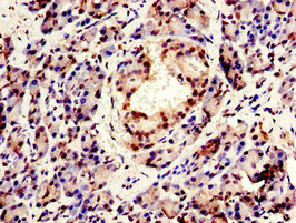 CPSF6 Antibody - Immunohistochemistry image of paraffin-embedded human pancreatic tissue at a dilution of 1:100