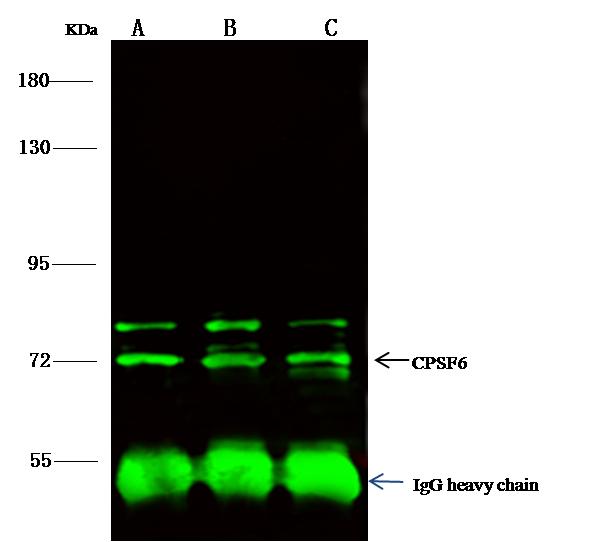 CPSF6 Antibody - CPSF6 was immunoprecipitated using: Lane A: 0.5 mg Hela Whole Cell Lysate. Lane B: 0.5 mg K562 Whole Cell Lysate. Lane C:0.5 mg Jurkat Whole Cell Lysate. 4 uL anti-CPSF6 rabbit polyclonal antibody and 15 ul of 50% Protein G agarose. Primary antibody: Anti-CPSF6 rabbit polyclonal antibody, at 1:100 dilution. Secondary antibody: Dylight 800-labeled antibody to rabbit IgG (H+L), at 1:5000 dilution. Developed using the odssey technique. Performed under reducing conditions. Predicted band size: 60 kDa. Observed band size: 72 kDa.